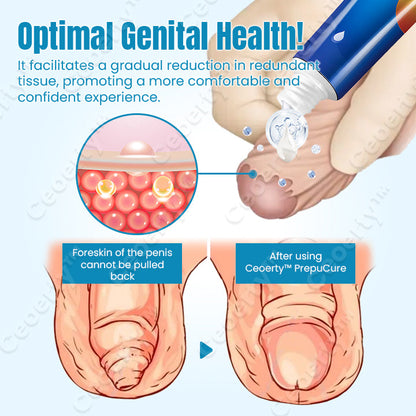 Ceoerty™ PrepuCure Foreskin Corrector Gel