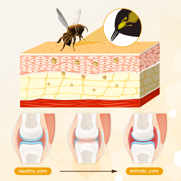 Biancat™ OrthoRestore Bee Venom Joint Relief Cream