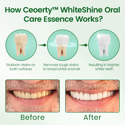 Ceoerty™ WhiteShine Oral Care Essence