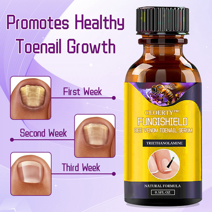 Ceoerty™ FungiShield Bee Venom Toenail Serum