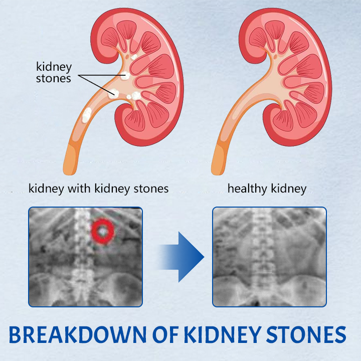 Ceoerty™ NephroFlex Kidney Boost Patch