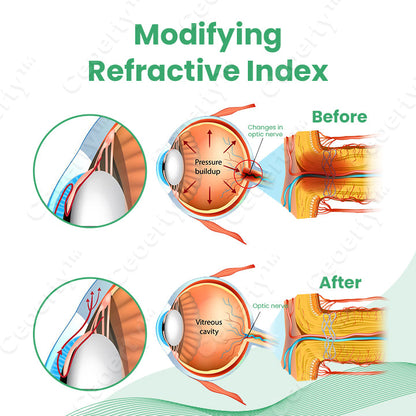 Ceoerty™ EYEase Myopia Cure Drops