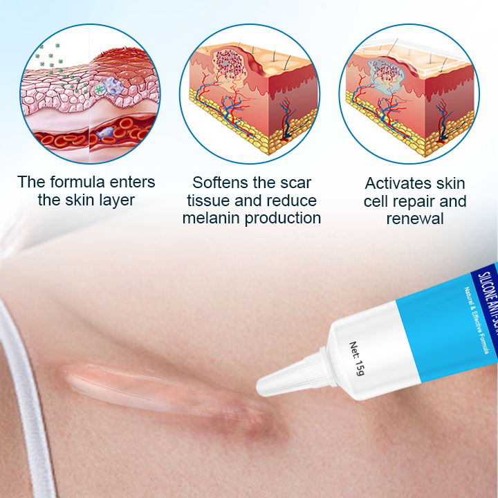 Biancat™ Silicone Anti-Scar Cream