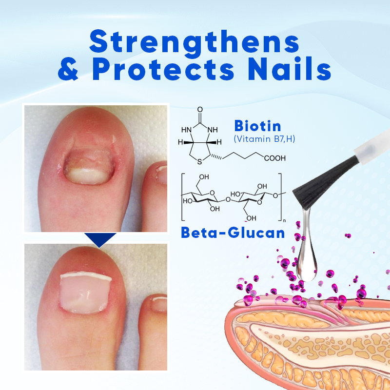 Biancat™ OnyxoGuard Nail Growth and Repair Serum👨‍⚕️Revive Your Nails, Complete Protection and Nourishment