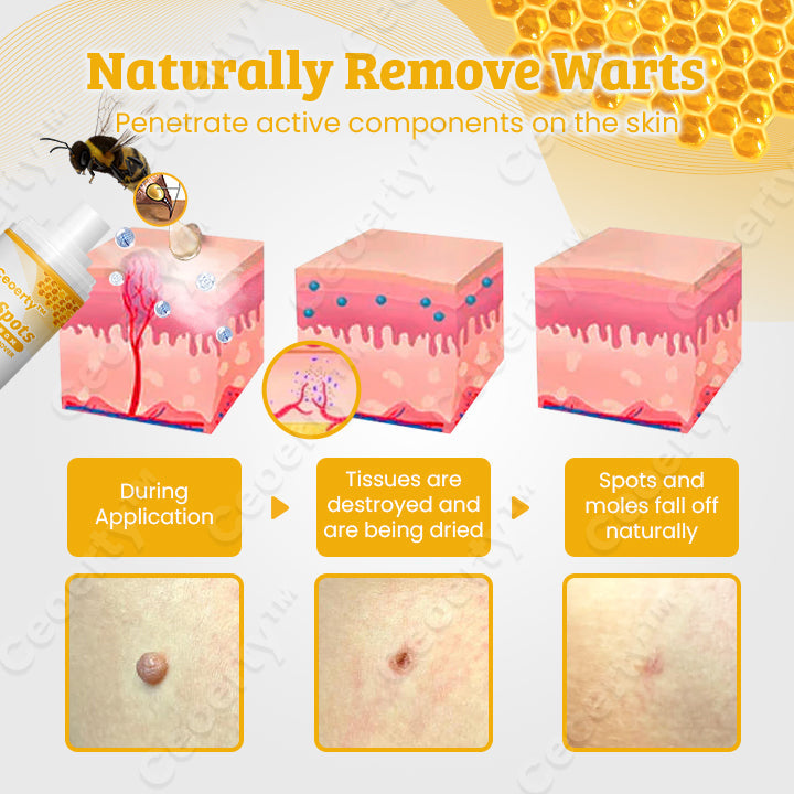 Ceoerty™ TagSpots Bee Venom Mole & Wart Remover