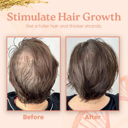 Ceoerty™ ShineLocks Rice Water Hair Growth Duo