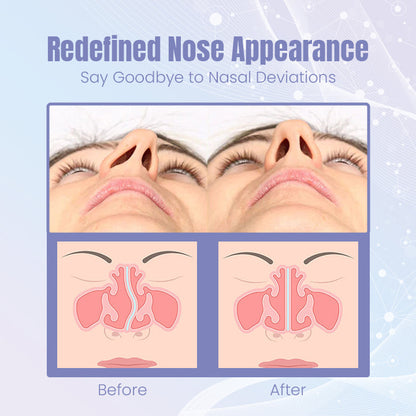 Ceoerty™ Sculptify Nose Enhancer Device